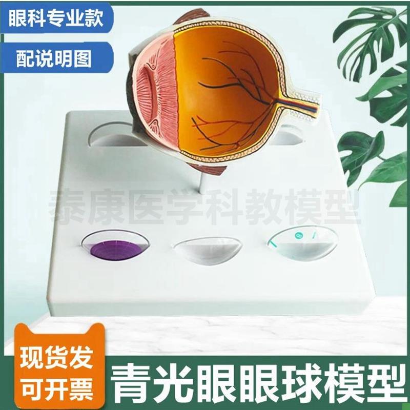 眼科模型青光眼模型眼底t视网膜血管神经晶状体浑浊视力模糊眼睛