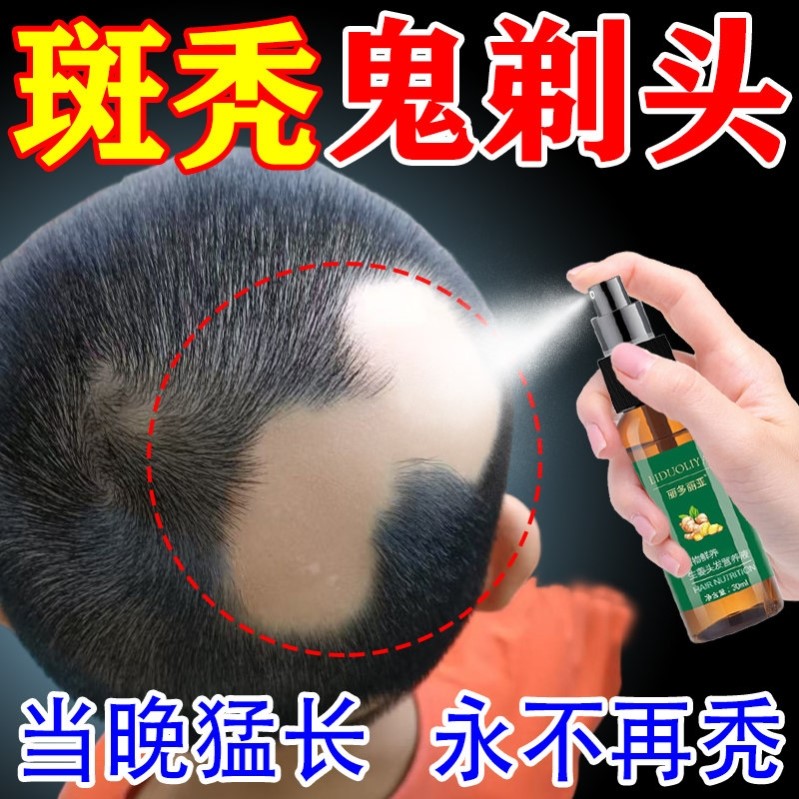 斑秃鬼剃头生发液增发剂防脱发儿童生发液增发密发生发剂快速生发