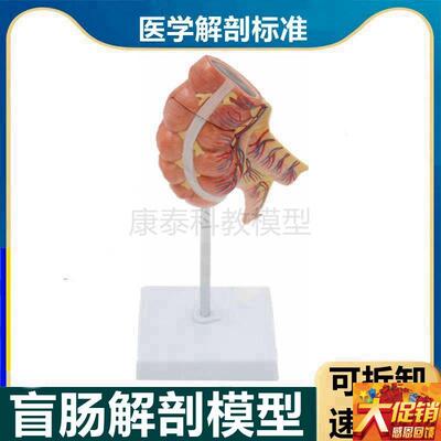 盲肠解剖模型阑尾肠n系膜淋巴血管结肠空肠回肠人体肠道病理医患