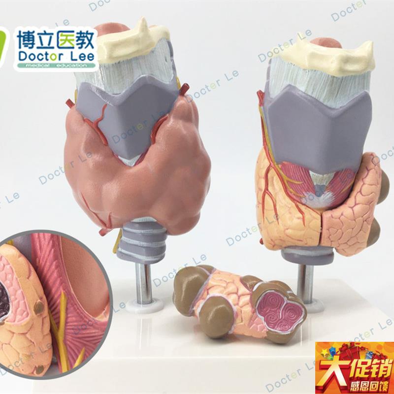 人体甲状腺病理模型甲亢甲低D甲 减 内分泌系统医学解剖