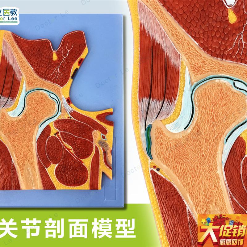 人体断层扫d描 髋关节切面 浮雕 髋关节断层解剖学模型 ct