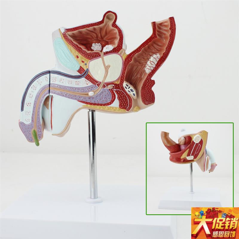 颐诺正品人体男性生殖泌尿疾病模型男科模型淋病前列Z腺增生模型