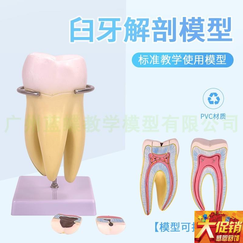 磨牙解剖放大模型 人体大磨牙模型6件套 M口腔牙教具磨牙牙齿模型
