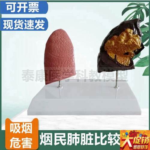 爱国卫生运动教育模型禁烟警示展示吸烟有K害健康模型危害人体器