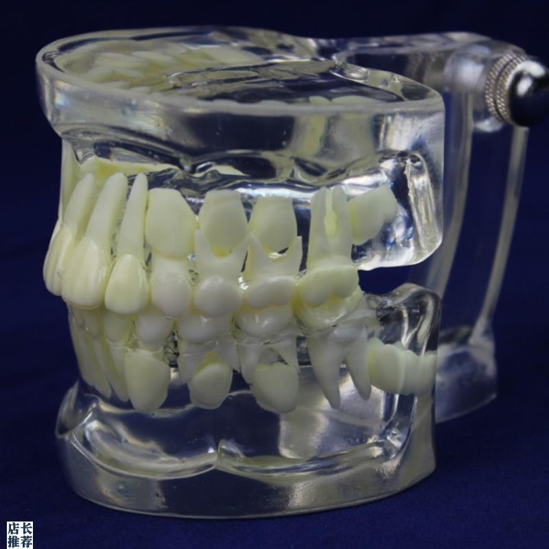 ENOVO颐诺全透明乳恒牙交y替模型儿童牙齿列发育指导刷牙模型