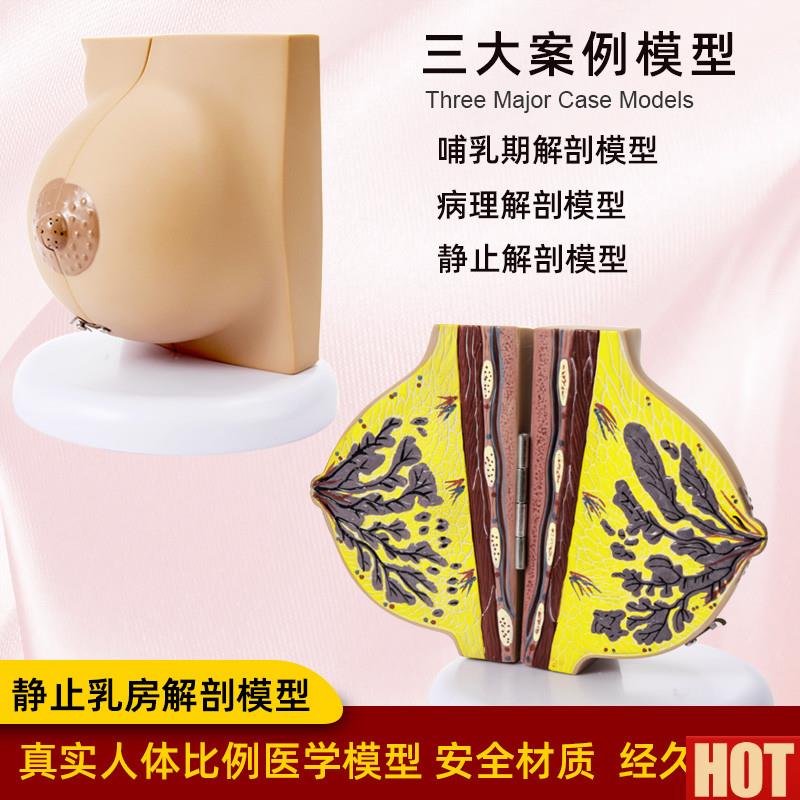 体乳房结构D解剖模型女性胸部乳腺静止期哺乳期病变仿真医学教具