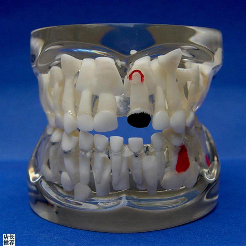ENOVO颐诺儿童乳牙早期病w态牙列模型牙齿发育幼儿牙齿护理教学具