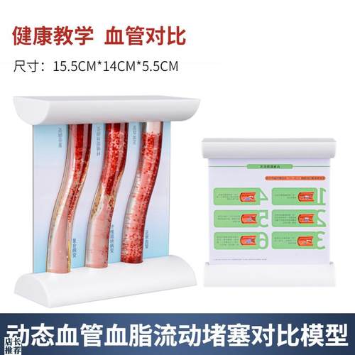 仿真动态高血脂血管堵塞对比模型浓D稠度对比教学病理血管对比模