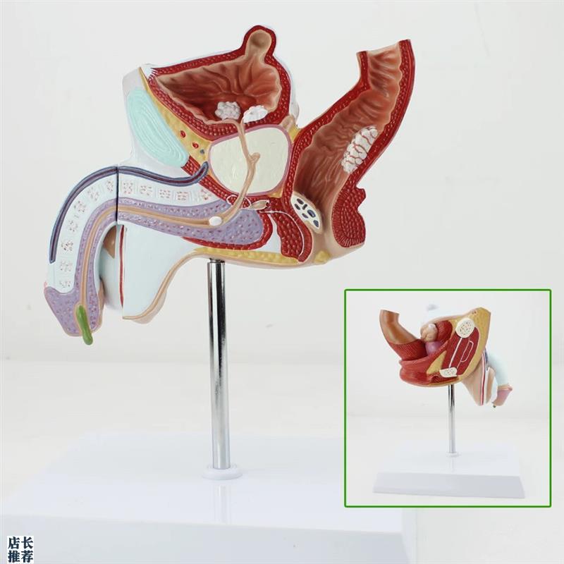 病理男性内d外生殖解剖模型病变生殖解剖模型男泌尿系统疾病模型