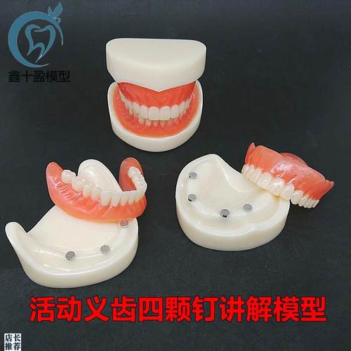 牙科模型活动义齿牙模讲解模型全口义齿四颗钉教学模W型T21包邮