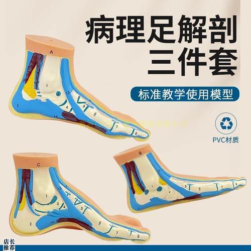 脚模型正常c足扁平足弓型足解剖模型脚部构结构造肌肉血管教学医