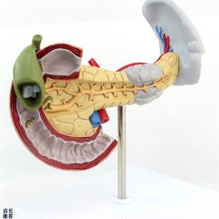 ENOVO颐诺医学用胰腺十二指肠和胆囊病理模型消化系X统消化科模型