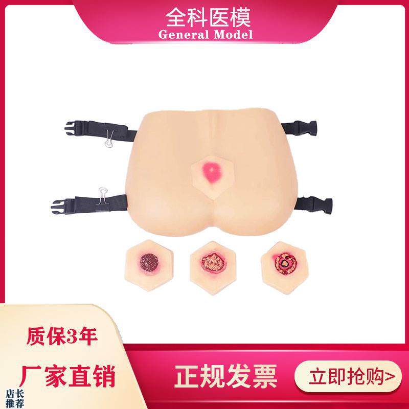阶段褥疮护理模型压疮培训教具臀部模型医学教学用模S型GM-RC-3