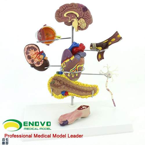 ENOVO颐诺人体医学糖尿病模型糖尿病并发症大R脑心脏胰腺神经元足