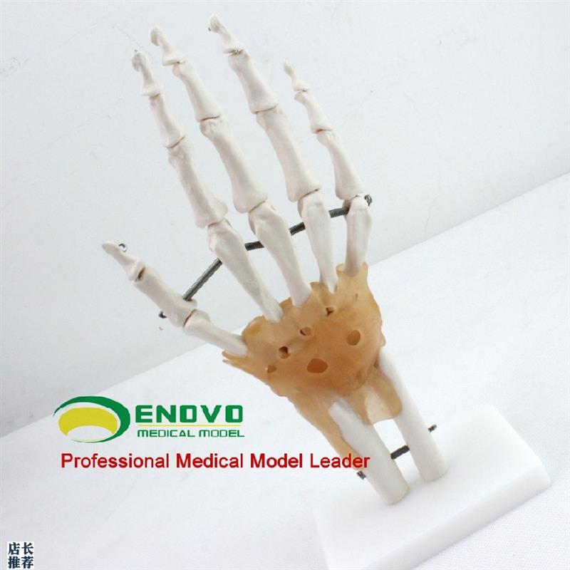 ENOVO颐诺医学人体手关节附韧带模型手骨尺桡骨人W体骨骼手足外科