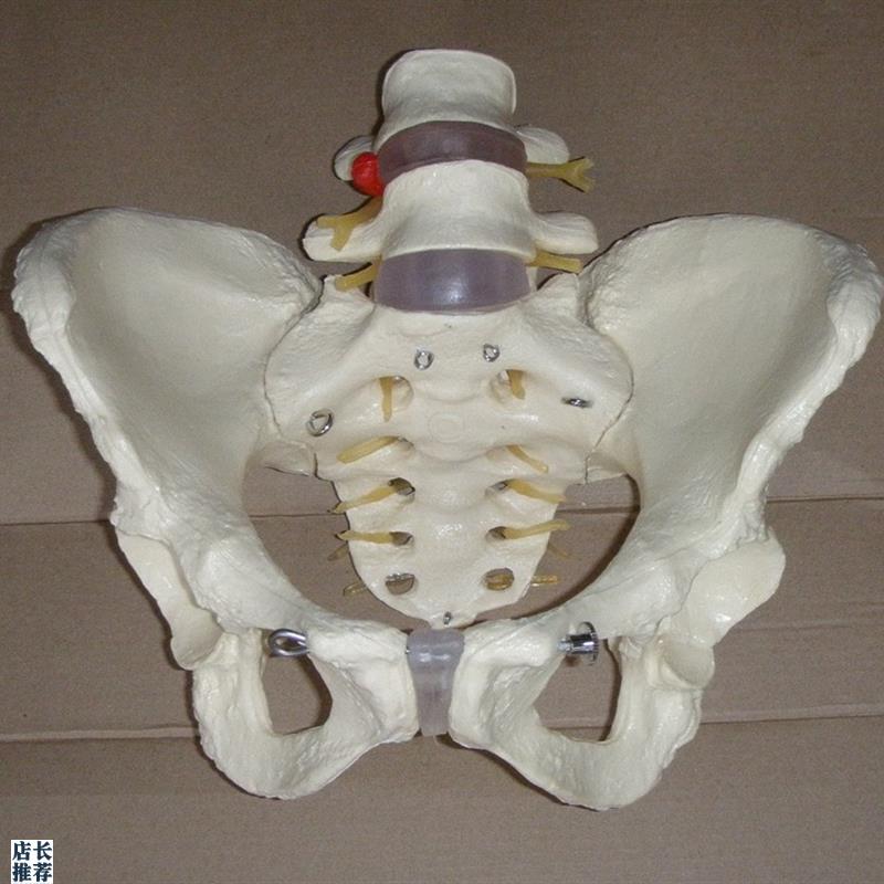 包邮1:1人体盆骨模型(病变.2节腰J椎)骨骼骨架教学医用教具