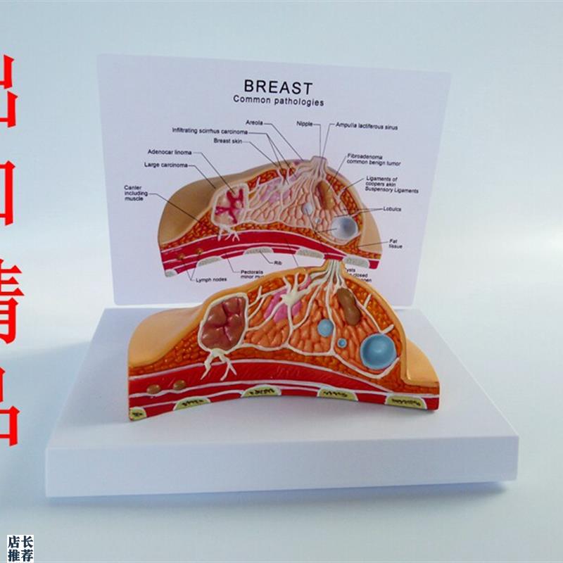 桌上型乳房f模型乳腺疾病肿块癌带说明板人体模型医学教具