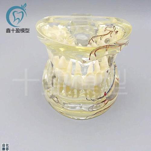 牙科水晶牙齿f病理模型M4019-2成人透明病理牙模型带牙神经和嵌体