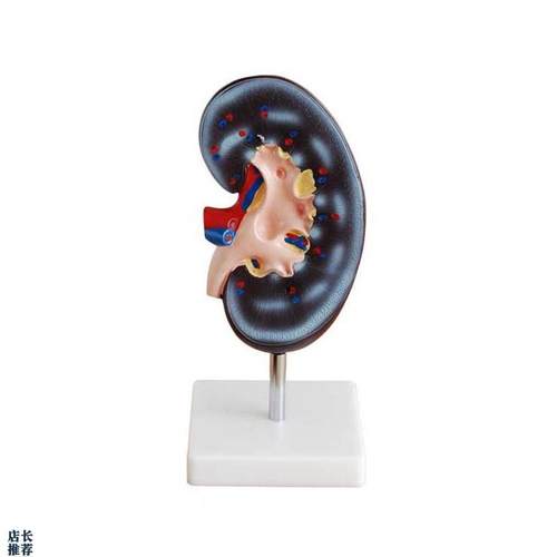 人体肾解剖模型1件肾解剖展示模P型人体肾展示模型