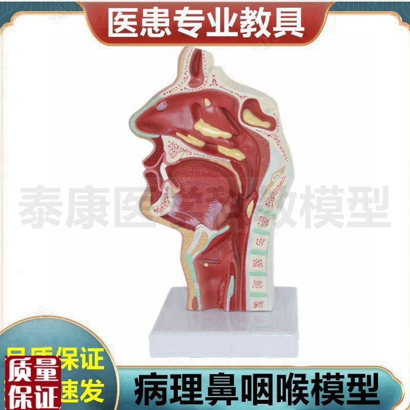 病理鼻咽喉e模型医患沟通鼻腔呼吸道扁桃体咽部食管气管声襞嗓