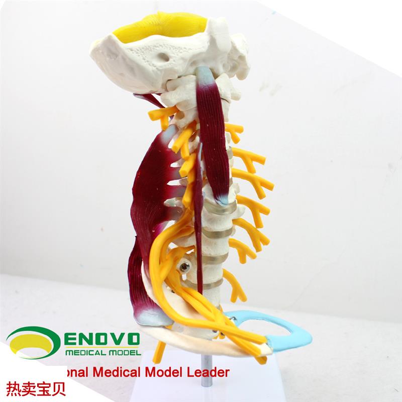 ENOVO颐诺医学人体颈椎模型颈臂丛神经肌肉模型人V体骨骼标本模型
