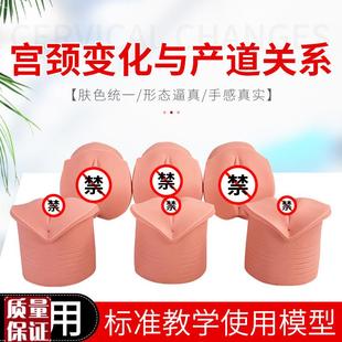 教学模型女性分娩生产宫口模型E产前宫颈变化与产道关系模