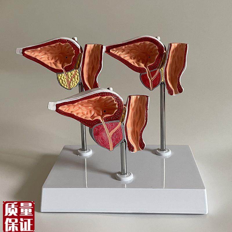 前列腺模型肥囊膀胱尿道狭窄男科医患医药促销中老人Z生殖腺体跨