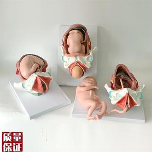 分娩过程助产g示教产程教学足月胎儿胎位产道子宫生殖产科妊娠过