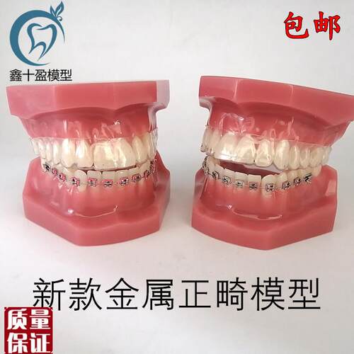 牙科口腔教d学模型隐形正畸矫正模型金属正畸模型口腔展示模