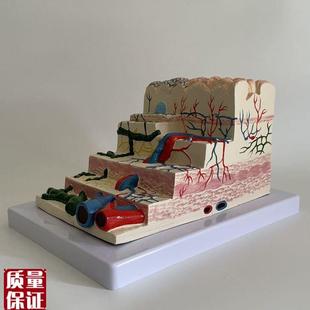 胃粘膜放大模型胃壁层次s血管淋巴管胃镜教学消化科医生示教医药