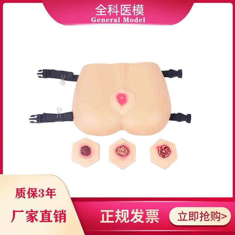 阶段褥疮护理模型压疮培训教具臀部模型医H学教学用模型GM-RC-3