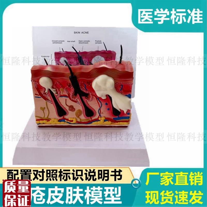 痤疮皮肤模型病理美容整形w医用毛发皮下毛囊人体皮肤解剖仿真医