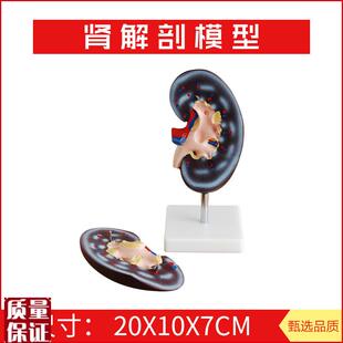 肾解剖模型2件右肾作额状切面示肾门肾Q血管输尿管肾盂肾