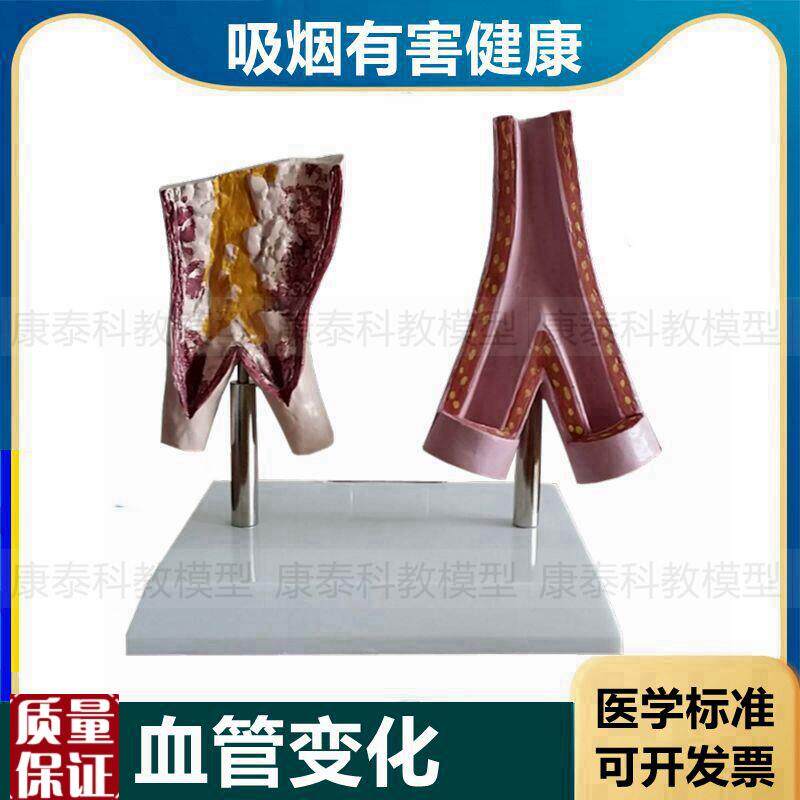 血管模型病理正常吸烟有害脏器心脏口J腔牙齿妊娠胎儿膀胱气管