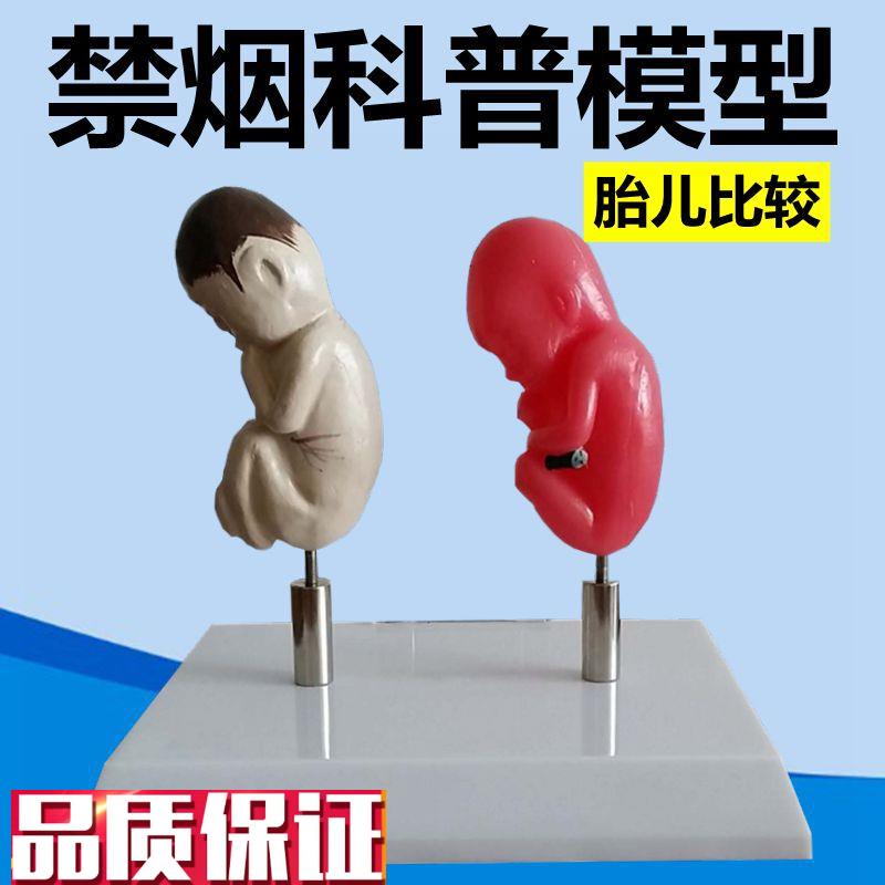 禁烟警示模型吸烟有害健康脏器功能受损妊娠期胎T儿女性戒烟教育