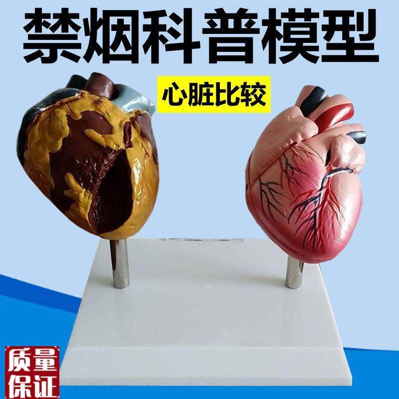 禁烟模型吸烟有害人体脏器功能心脏血管L牙齿呼吸泌尿膀胱女性妊