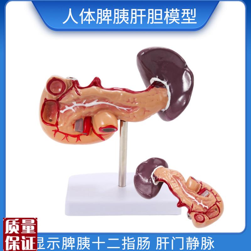 教学仿真人体胰脾肝胆十二指肠模型1:1自然R大普通胰腺内脏标