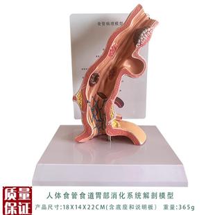 人体食管食道胃部消化系统解剖模型教学内脏解剖人体Y教具厂家直