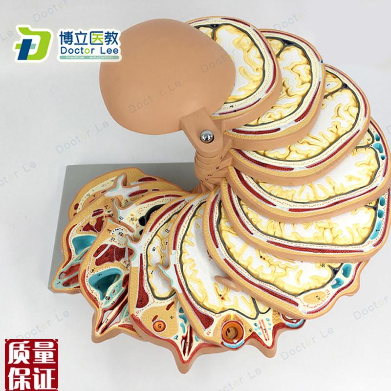 正品人体c头部断层头颅脑水平切模型脑CTMRI大脑模型影像放射