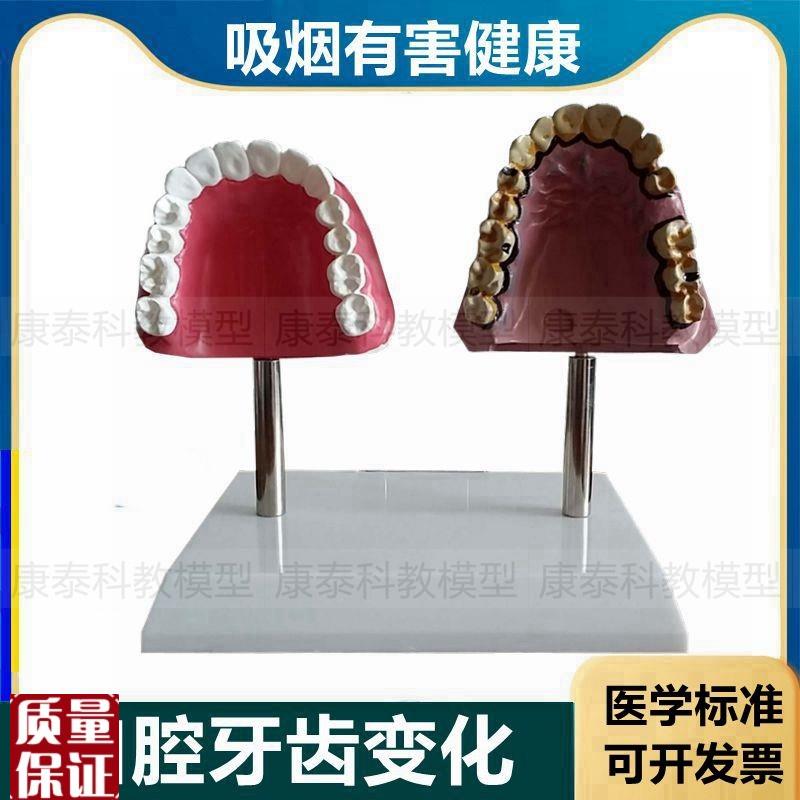 烟民牙齿吸烟危害口腔健康科普展示F禁烟场所摆件戒烟宣传教育模
