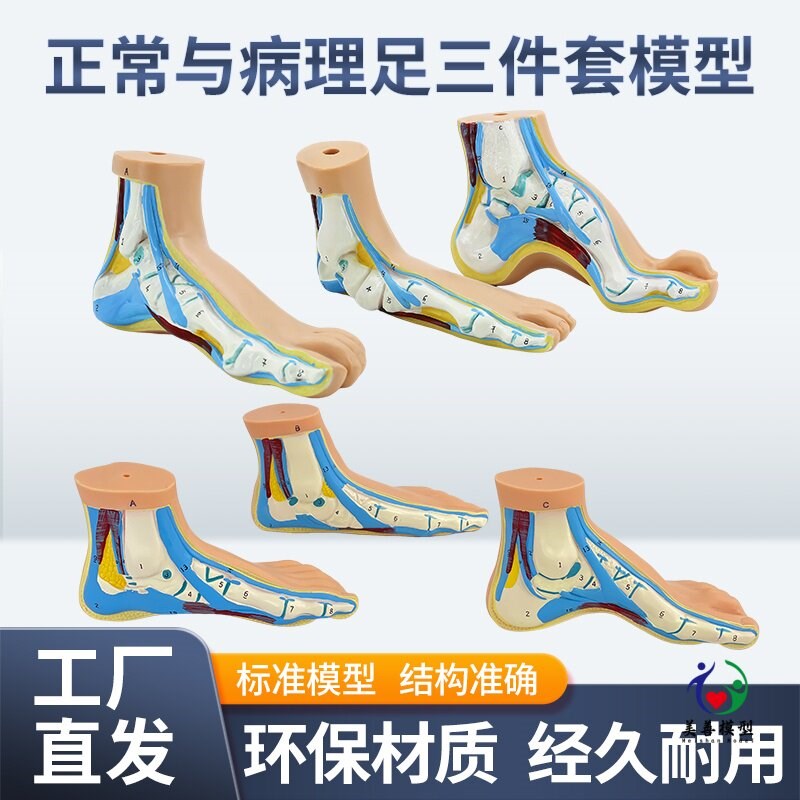 教学人体正常足扁平足弓形足高弓足 G足弓足部病理肌肉解剖脚模型