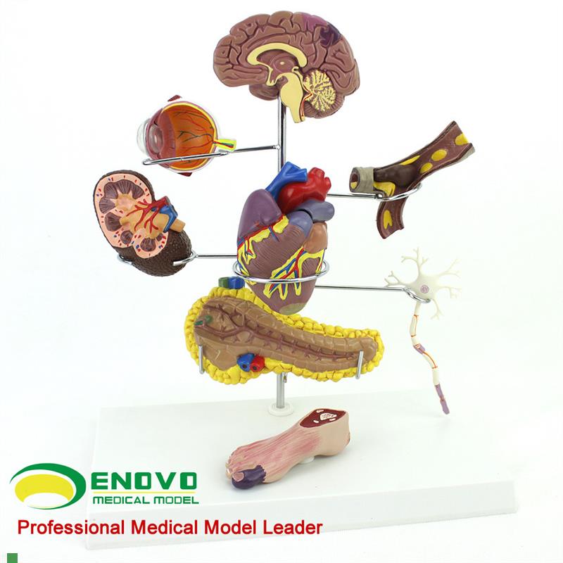 ENOVO颐诺人体m医学糖尿病模型糖尿病并发症大脑心脏胰腺神经元足