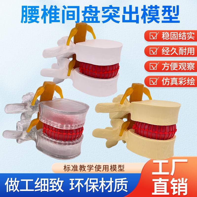 教学仿真人体腰椎间盘演示t突出模型脊柱测压演示脊椎压力病变脊