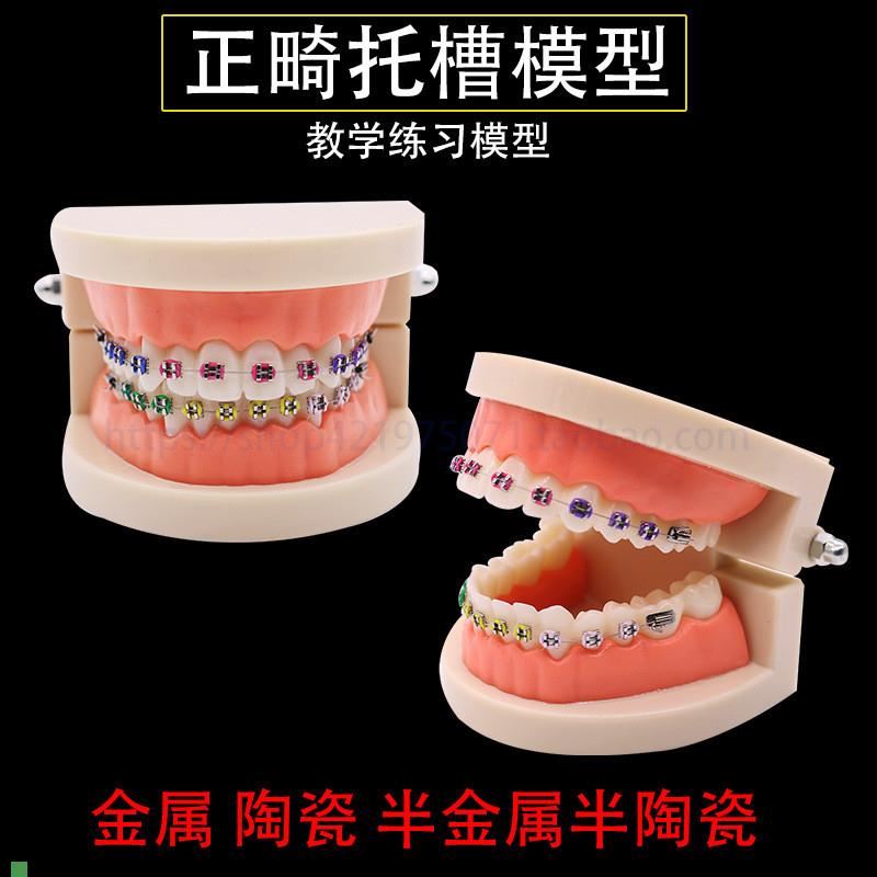 牙科正畸带托槽假牙模型医患沟通教学模型矫正练习托Z槽模型包邮