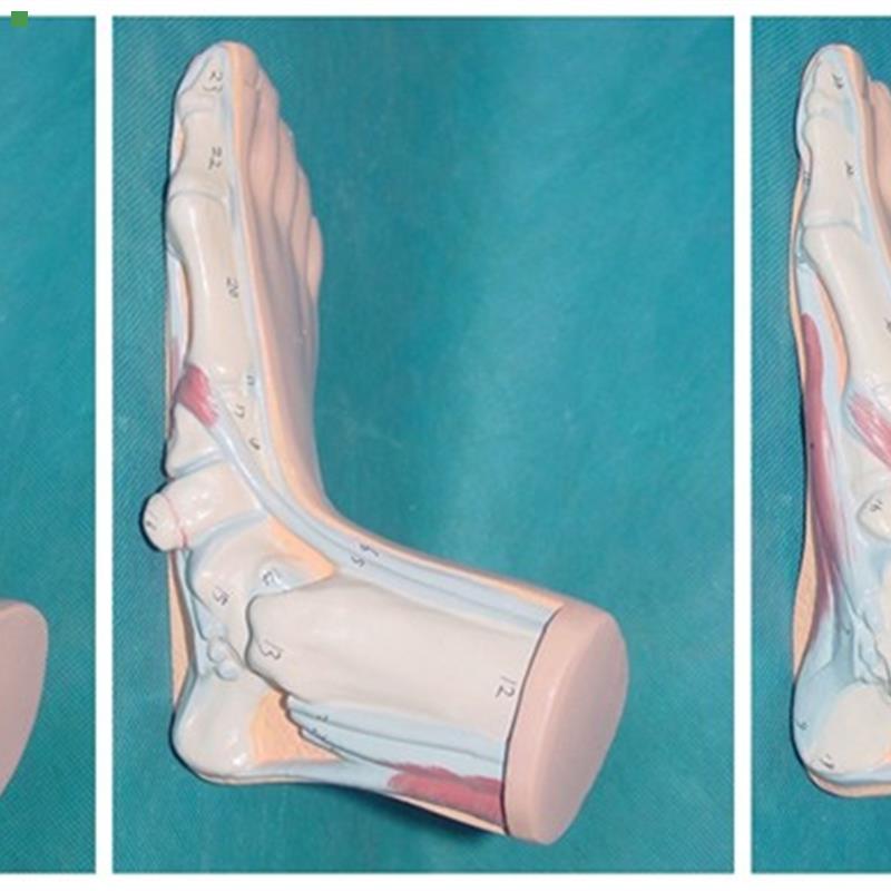 包邮人体脚模型 教学型 医用讲解弓形平掌正常脚脚掌比较