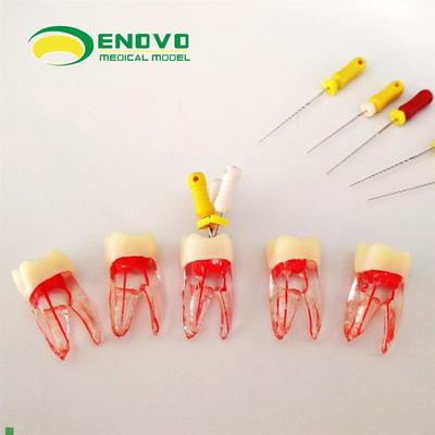 ENOVO颐诺齿科根管离体牙根x管治疗练习摸拟RCT根管教学练习牙体