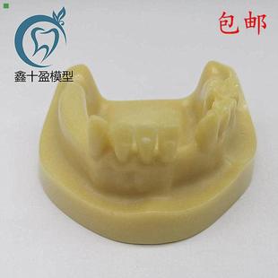 教学模型M2028 发泡缺失种植练习 牙科材料 下半口种植练习模型