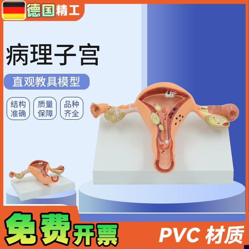 德国人体模型女性生n殖子宫阴道卵巢子宫教学模具病理变化科普培