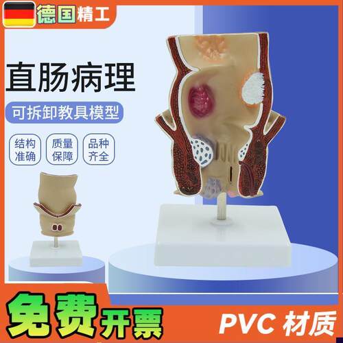 德国】人体直肠痔疮病变s解剖模型结肠肛肠科肛门括约肌教学标本