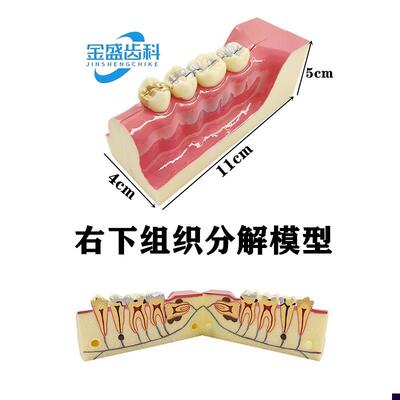 牙科口腔教学模型 右下组织分解模型 龋齿解刨牙神经展.示模型包